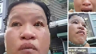 Tái diễn nạn giả bệnh nhân nghèo để xin từ thiện