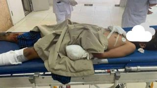 Thân thể giập nát te tua vì "mày mò chế pháo nổ"