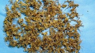 Cấp cứu kịp thời một bệnh nhân nuốt hàng ngàn mảnh xương rắn