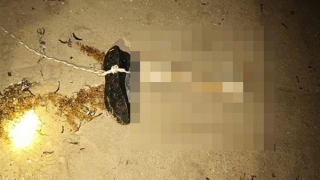 Một đoạn xương chân người có mang giày trôi vào bãi biển