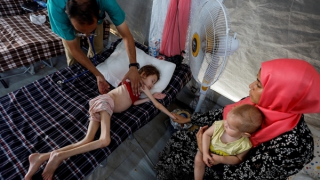 Xót xa những đứa trẻ suy dinh dưỡng giữa vùng chiến Gaza