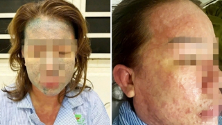 Nữ bệnh nhân nguy kịch sau khi dùng “thuốc giảm cân thải độc, collagen không rõ nguồn gốc”
