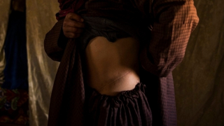 Bi kịch ở “ngôi làng một thận” tại Bangladesh