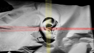 Tái tạo thính lực nhờ cấy tế bào gốc