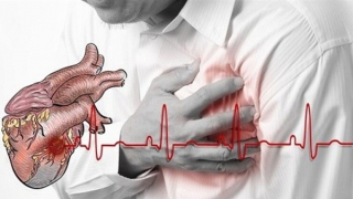 Đề xuất dự án máy sốc điện cộng đồng để cấp cứu ngừng tim