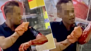 Côn đồ cầm hung khí xông vào quán, chém nhân viên giữ xe trọng thương