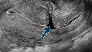 7 năm khát khao có thêm con thứ hai, vợ chồng “sốc” vì nguyên nhân ít ai ngờ tới