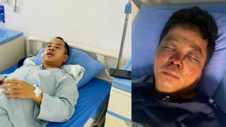 Bắc Ninh: Điều tra vụ giúp người gặp tai nạn giao thông rồi bị hành hung