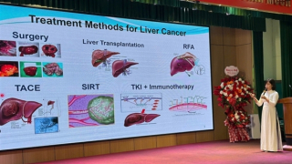 Nhiều kỹ thuật mới trong điều trị ung thư gan, mang lại hy vọng cao cho người bệnh