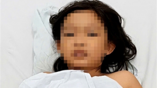 Cứu sống bệnh nhi 9 tuổi bị ngộ độc ốc biển chưa rõ danh tính
