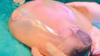 Hiếm gặp: Bé trai sinh ra trong "bọc điều"