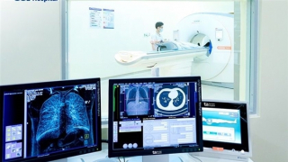 Ung thư phổi sau nhiều năm hút thuốc lá