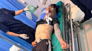 Mâu thuẫn trong lúc nhậu, hai anh em chém bị thương nhiều người