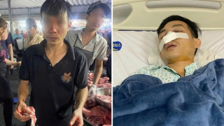 Điều tra nhóm bảo vệ chợ đầu mối Hóc Môn đánh người gãy mũi, tét mí mắt