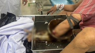 Nguy cơ tiềm ẩn và hậu quả khó lường từ máy xay thịt