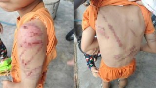 Điều tra vụ bé trai 10 tuổi bị bố bạo hành