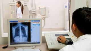 Bộ Y tế yêu cầu điều chỉnh việc chụp X-quang dưới 6 phút không thanh toán BHYT