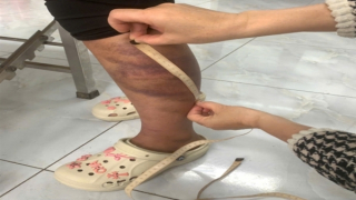 Tạm giữ người đàn ông nhiều lần bạo hành vợ đang mang thai và con gái 13 tuổi