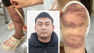 Khởi tố kẻ hành hạ vợ con tàn nhẫn