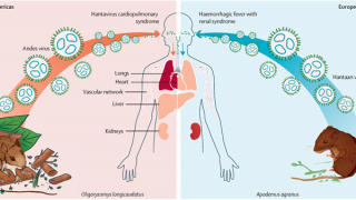 Ba người tử vong trên tàu du lịch Đại Tây Dương nghi nhiễm virus hiếm gặp
