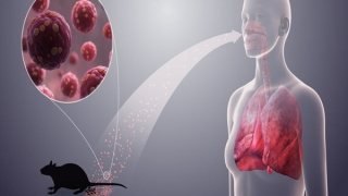 Bộ Y tế cảnh báo khẩn về loại virus lây từ chuột sau chùm ca bệnh tử vong trên tàu du lịch