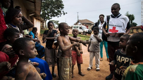 Quốc gia châu Phi tuyên bố bùng dịch Ebola dù chỉ có một ca được ghi nhận  -0