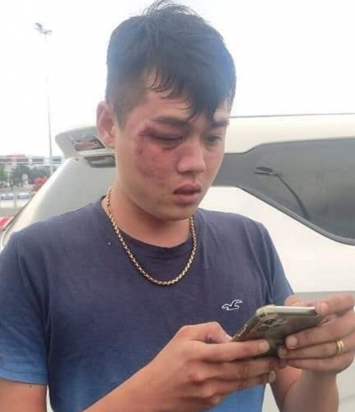 Đà Nẵng: Bắt đối tượng côn đồ tấn công tài xế dã man sau sự cố va chạm giao thông   -0