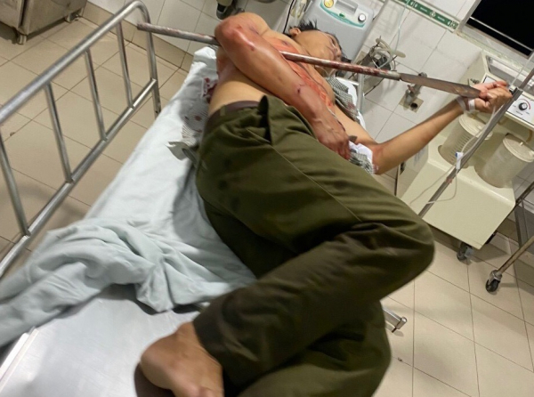 Tổ trưởng dân phòng bị trọng thương khi ngăn chặn 2 nhóm thanh niên đi hỗn chiến -0