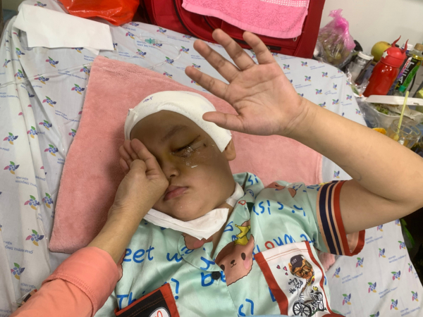 Bé gái 9 tuổi bị tay phanh xe đâm vào ổ mắt trái và nhu mô não -0