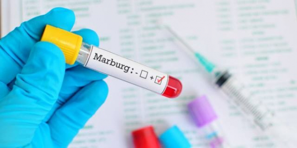 Giám sát chặt nguy cơ lây lan virus Marburg vào Việt Nam -0
