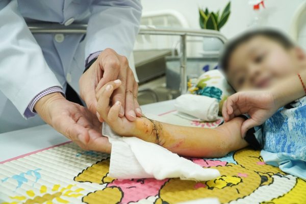 Quy trình báo động đỏ kịp thời nối liền cánh tay cho bé 5 tuổi bị đứt lìa  -0