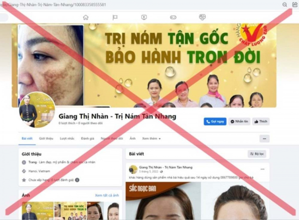 “Giang Thị Nhàn – trị nám tàn nhang” là “thần y” ảo -0