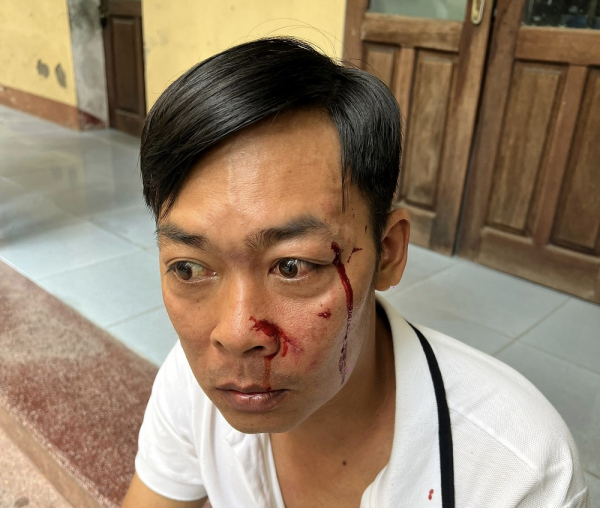 1 người đàn ông bị tấn công bằng dao khi vừa rời cổng tòa án -0