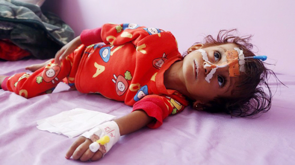 Thế giới “bất lực” trong phòng, chống suy dinh dưỡng ở Yemen? -0