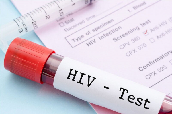 Bộ Y tế vào cuộc vụ tự ý lấy máu của học sinh để xét nghiệm HIV  -0