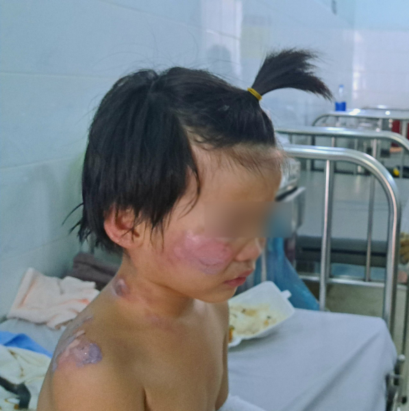 Thông tin mới nhất về vụ 4 cháu bé trong vụ cháy nhà ở Tây Ninh -0
