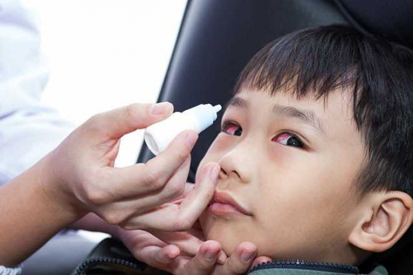 Bộ Y tế đưa ra 5 khuyến cáo phòng dịch đau mắt đỏ -0