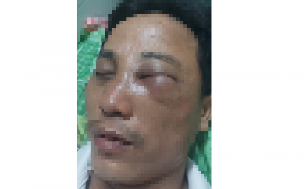 Xử lý nghiêm đối tượng hành hung Phó Hiệu trưởng Trường PTTH Hàm Tân, Bình Thuận -0