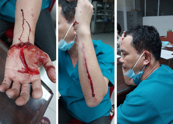 Điều tra vụ cán bộ điều dưỡng Bệnh viện Đa khoa Bình Phước bị hành hung -0