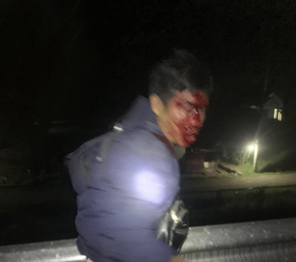 Lại xảy ra tai nạn trên cao tốc Cam Lộ - La Sơn, 2 người tử vong -0
