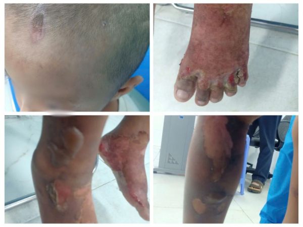 Truy tìm cha của bé 6 tuổi nghi bị bạo hành để làm rõ vụ việc -0