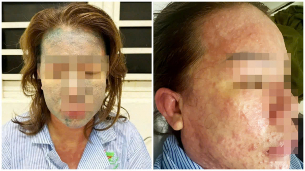 Nữ bệnh nhân nguy kịch sau khi dùng “thuốc giảm cân thải độc, collagen không rõ nguồn gốc” -0