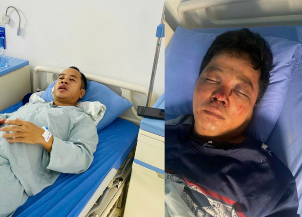 Công an đang xác minh vụ việc giúp người gặp tai nạn rồi bị hành hung -0