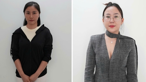 Khởi tố, bắt tạm giam chủ cơ sở thẩm mỹ “dỏm” lừa đảo hơn 2 tỷ đồng