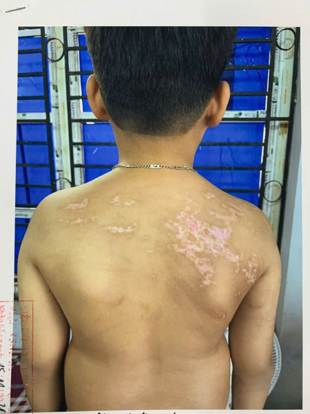 Tạm giam người bố bạo hành con trai 7 tuổi -0