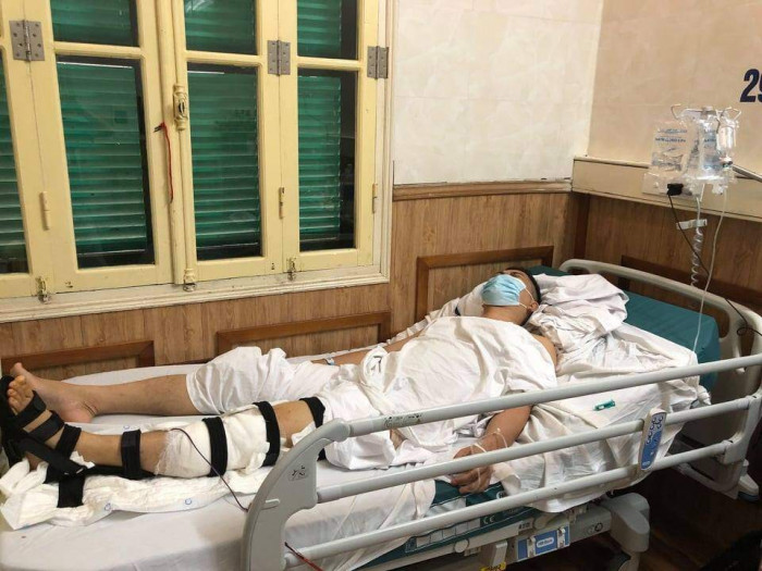 Khởi tố đối tượng “thông chốt” tông chiến sỹ Công an bị thương -0