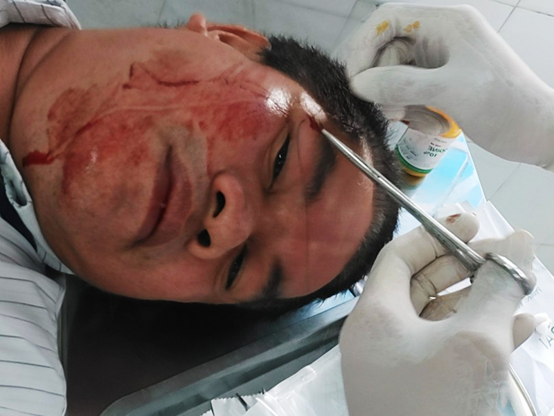 Khởi tố đối tượng đánh cán bộ xã Long Sơn, TP Vũng Tàu  -0