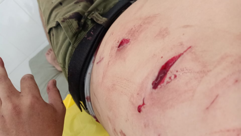 Người dân quận 12 lại bị khỉ hoang tấn công gây thương tích -0