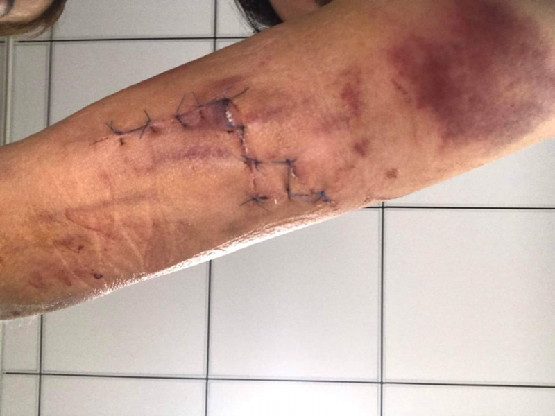 Con khỉ hoang tấn công người dân ở quận 12 đã bị bắn hạ -0