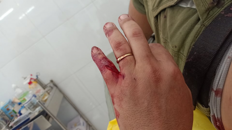 Con khỉ hoang tấn công người dân ở quận 12 đã bị bắn hạ -0